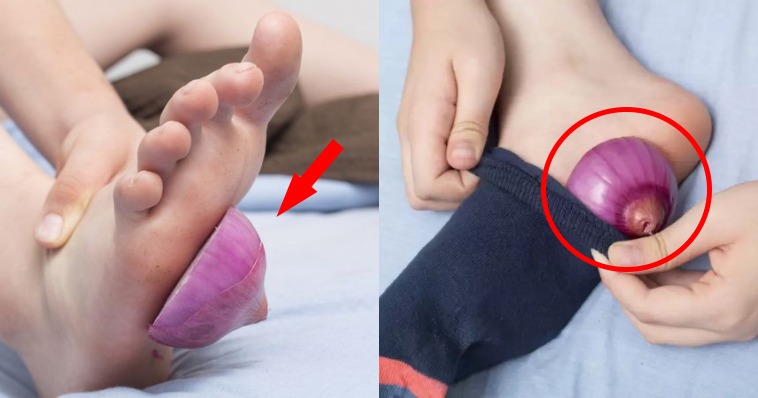 Sleeping with onions on your feet