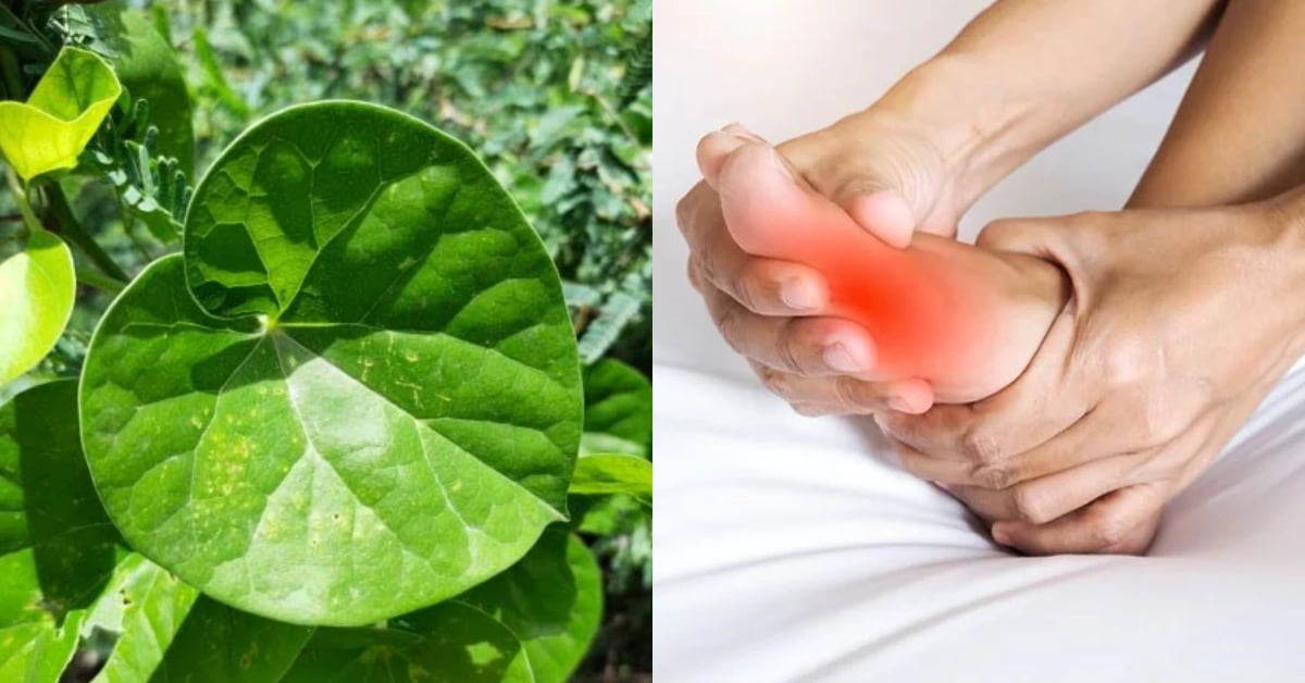 Uric Acid