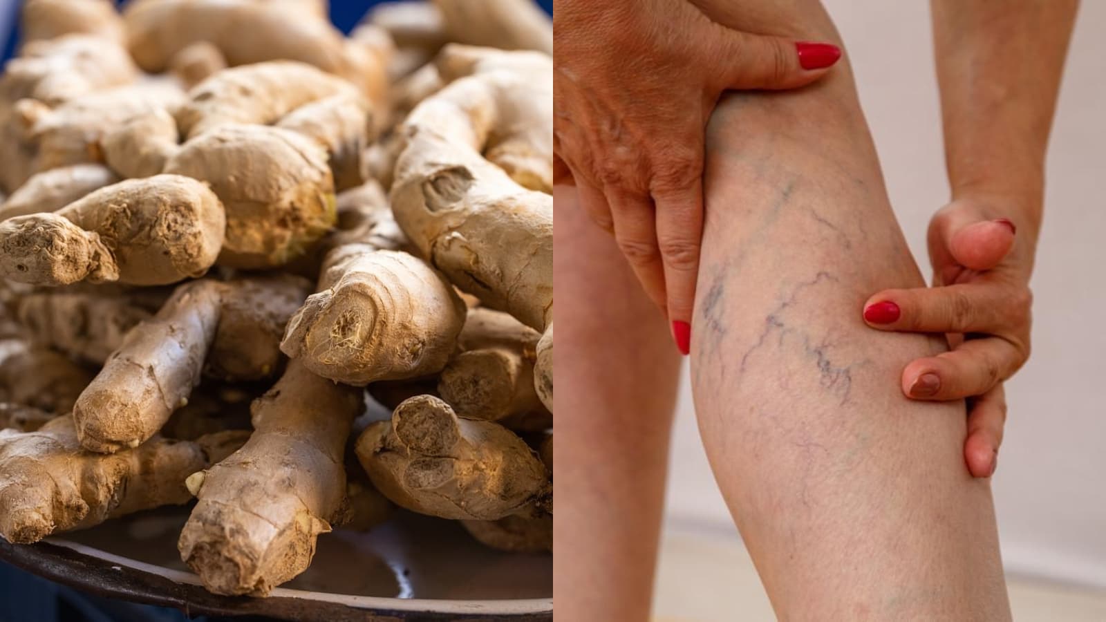 Varicose Veins Home Remedies